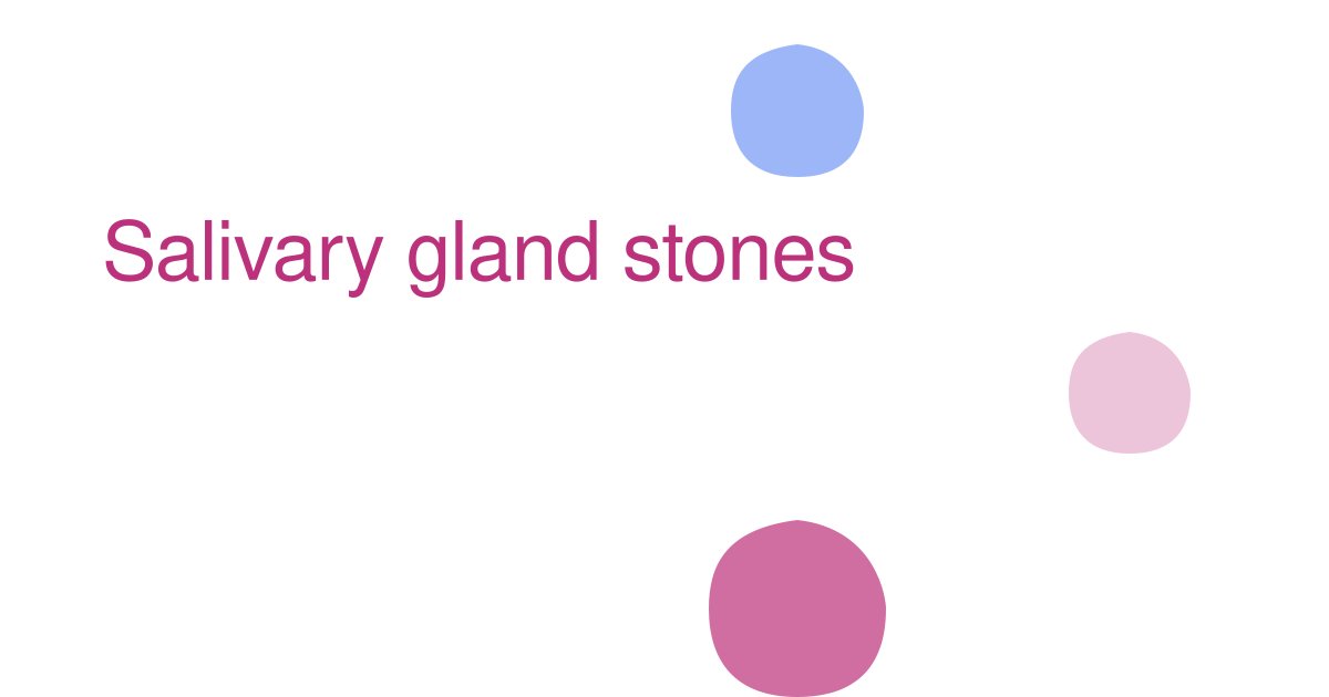 Salivary gland stones